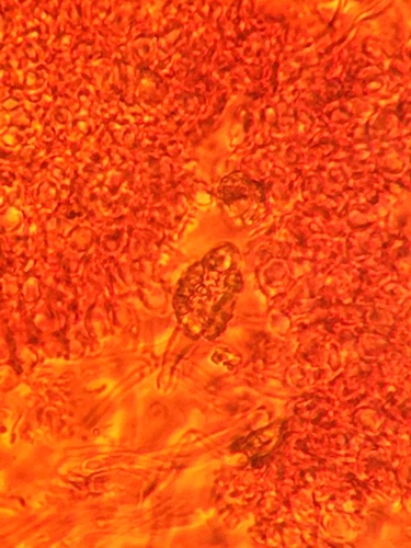 Resupinatus (Photo 6 of 9)