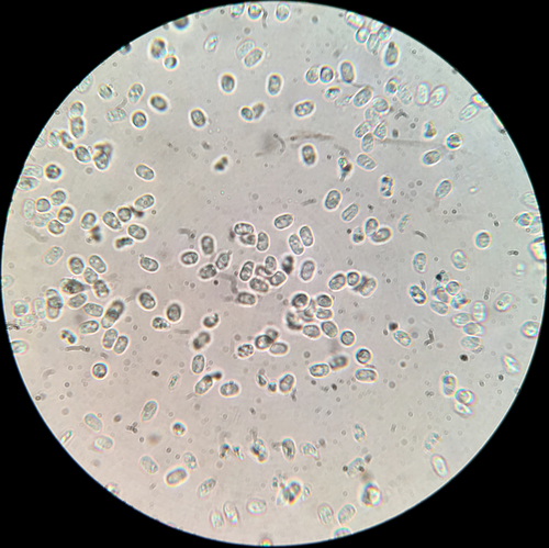 Resupinatus (Photo 9 of 9)