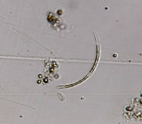 Closterium acutum var. variabile