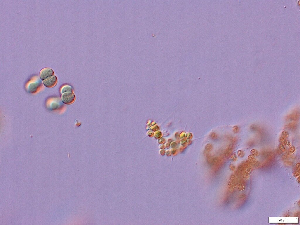 Micractinium from Brisbane QLD, Australia on June 22, 2018 at 1155 AM