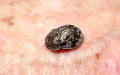 Ospidus chrysomeloides