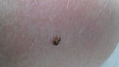 Lignyodes enucleator