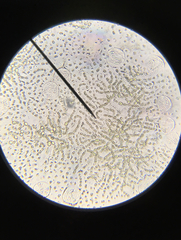 Anabaena