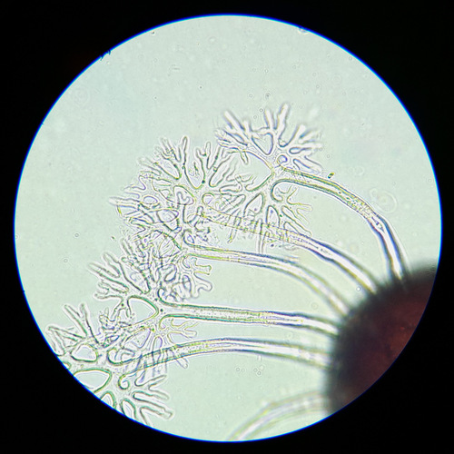Erysiphe sambucina