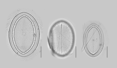 Cocconeis placentula