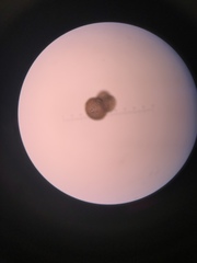 Foraminifera