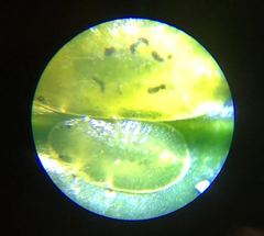 Coccus viridis