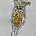 Philodina megalotrocha - Photo (c) zookanthos, algunos derechos reservados (CC BY), subido por zookanthos