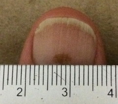 Platythyrea lamellosa