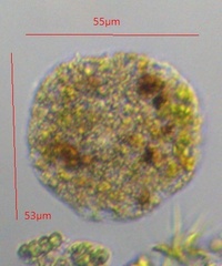 Amoebozoa
