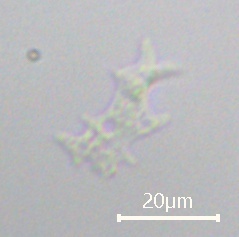 Amoebozoa