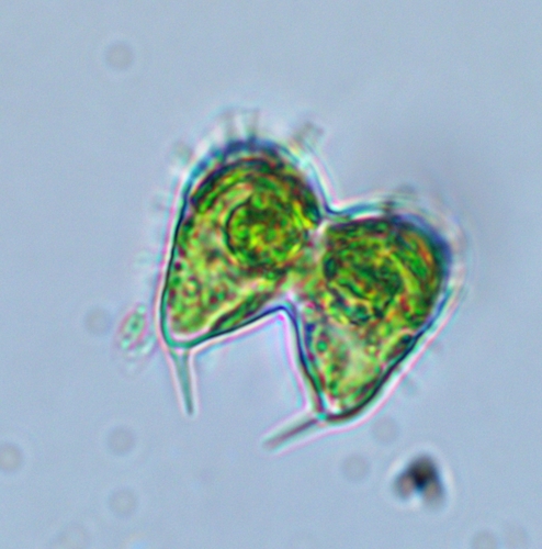 Staurodesmus glaber