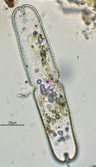 Tetmemorus brebissonii