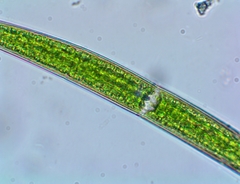 Closterium intermedium