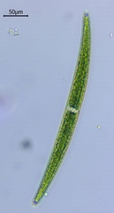 Closterium intermedium