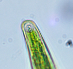Closterium intermedium