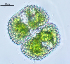 Cosmarium margaritatum