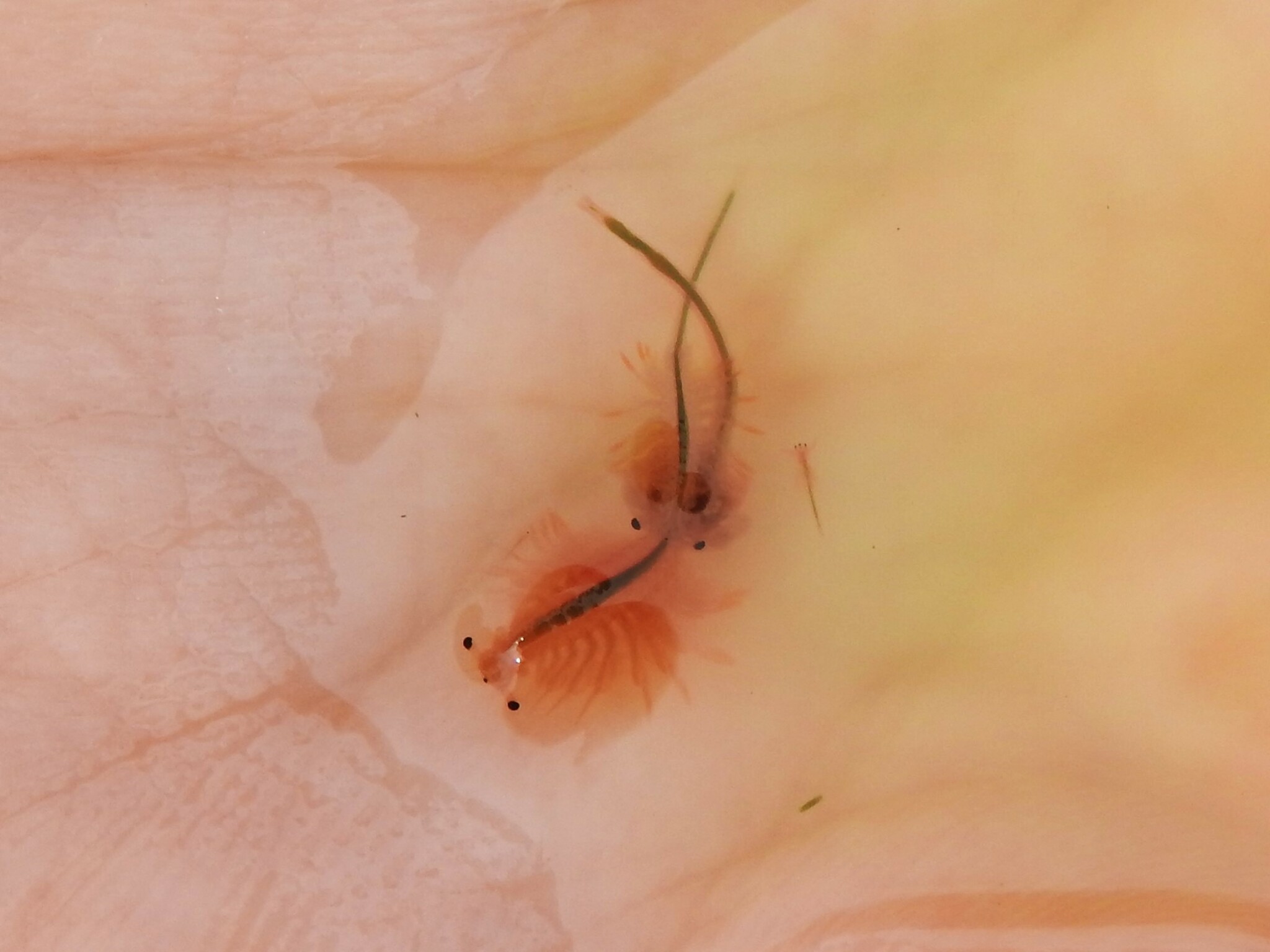 Artemia salina (Linnaeus, 1758)
