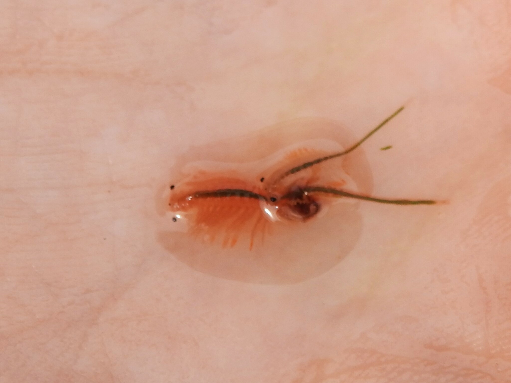 Artemia salina (Linnaeus, 1758)