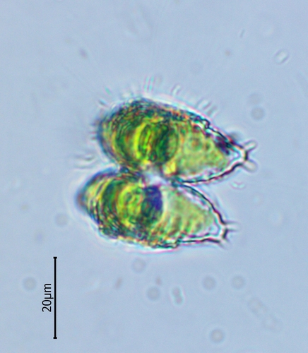 Staurastrum avicula