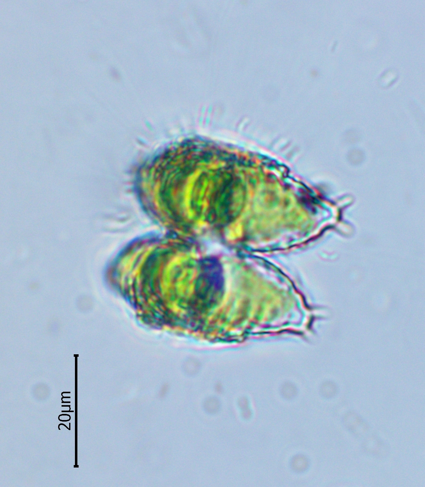 Staurastrum avicula