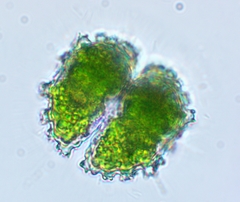 Staurastrum spongiosum