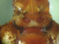 Dermacentor occidentalis