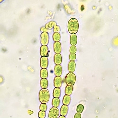 Anabaena azollae