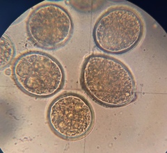 Sphaerosporium lignatile