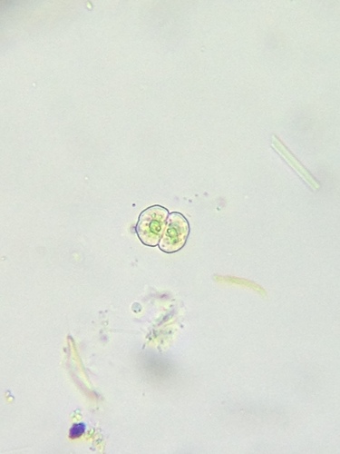 Cosmarium angulosum