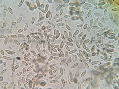 Rhizopogon salebrosus
