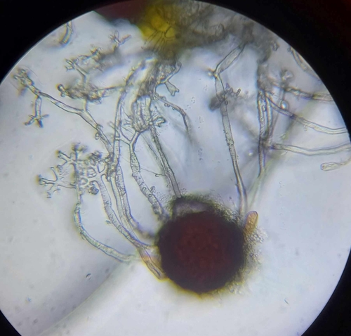 Erysiphe euonymi