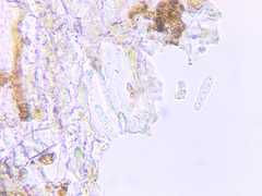 Arthonia punctiformis