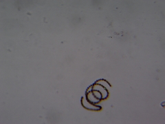 Anabaena
