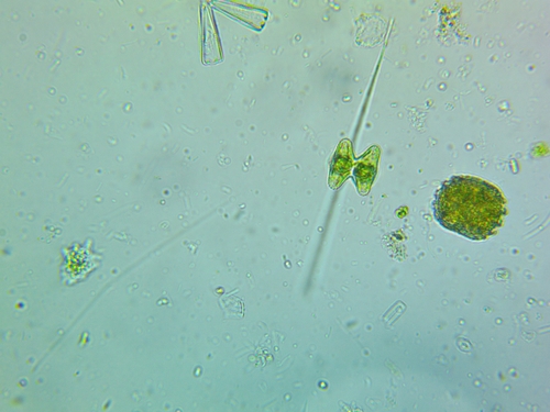 Staurastrum dilatatum