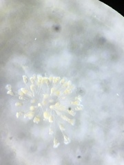 Conochilus hippocrepis