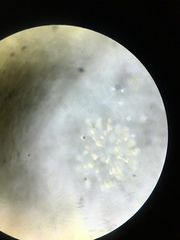 Conochilus hippocrepis