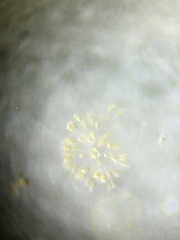 Conochilus hippocrepis