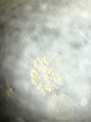 Conochilus hippocrepis