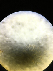 Conochilus hippocrepis