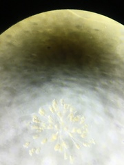 Conochilus hippocrepis