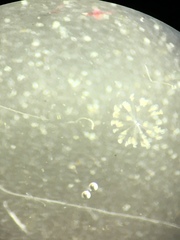 Conochilus hippocrepis