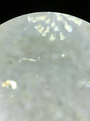 Conochilus hippocrepis