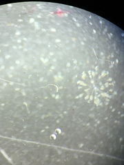 Conochilus hippocrepis