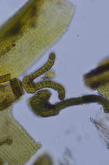 Racomitrium sudeticum