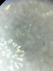 Conochilus hippocrepis