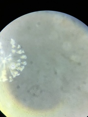 Conochilus hippocrepis