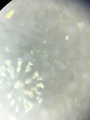 Conochilus hippocrepis