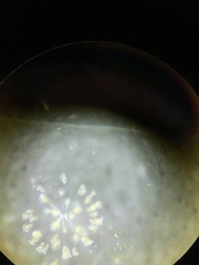 Conochilus hippocrepis