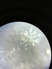 Conochilus hippocrepis